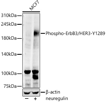 Phospho-ErbB3/HER3-Y1289 Monoclonal Antibody [9G3C2]