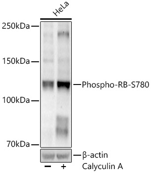 Phospho-RB-S780 Monoclonal Antibody [8R5F5]