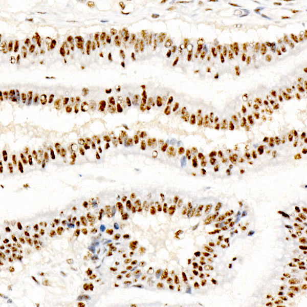 Phospho-CREB1-S133 Monoclonal Antibody