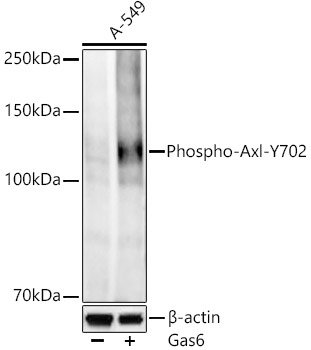Phospho-Axl-Y702 Monoclonal Antibody [2X10M2]
