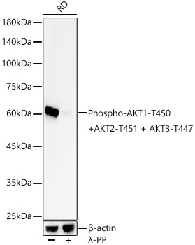 Phospho-AKT1-T450 + AKT2-T451 + AKT3-T447 Monoclonal Antibody [8U6D2]