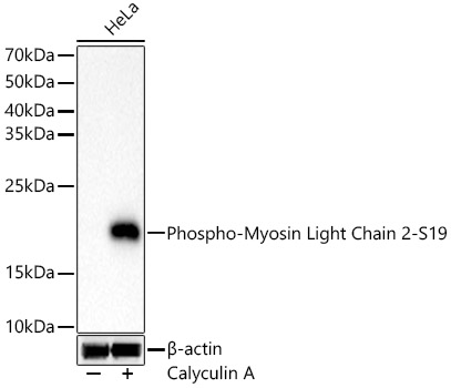 Phospho-Myosin Light Chain 2-S19 Monoclonal Antibody [6D8B7]