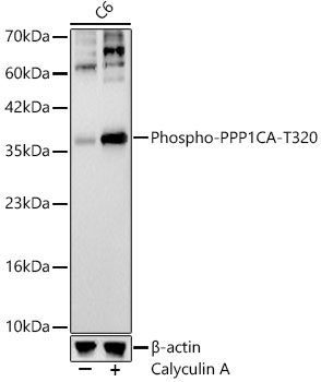 Phospho-PPP1CA-T320 Monoclonal Antibody [7W8T8]