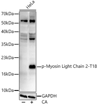 Phospho-Myosin Light Chain 2-T18 Monoclonal Antibody [8X1X2]