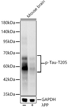 Phospho-Tau-T205 Monoclonal Antibody [9G3H8]