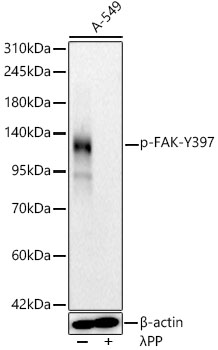 Phospho-FAK-Y397 Monoclonal Antibody [2J5V2]
