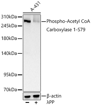 Phospho-Acetyl CoA Carboxylase 1-S79 Monoclonal Antibody [4B8D3]