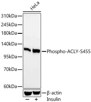 Phospho-ACLY-S455 Monoclonal Antibody [6S0P10]
