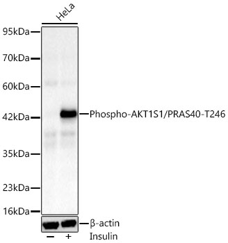 Phospho-AKT1S1/PRAS40-T246 Monoclonal Antibody [3A1F3]