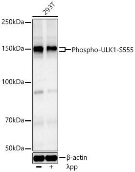Phospho-ULK1-S555 Monoclonal Antibody [8I9C3]