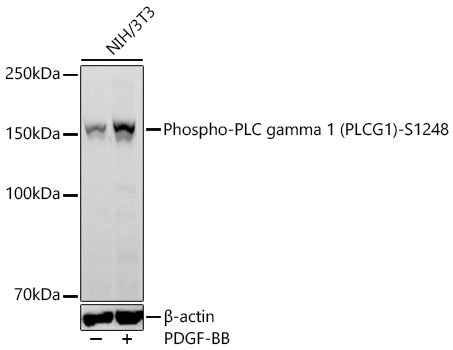 Phospho-PLC gamma 1 (PLCG1)-S1248 Monoclonal Antibody [4I4E6]