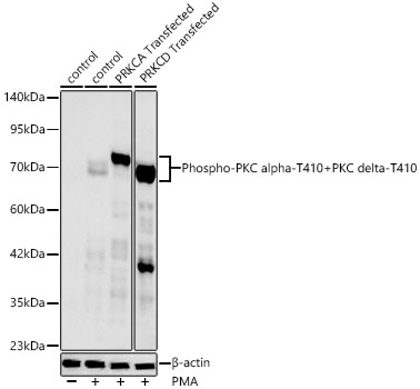 Phospho-PKC alpha-T410+PKC delta-T410 Monoclonal Antibody [5W5G1]