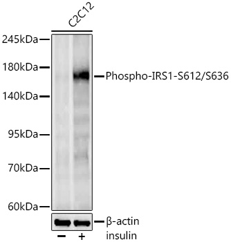 Phospho-IRS1-S612/S636 Monoclonal Antibody [2F5N9]