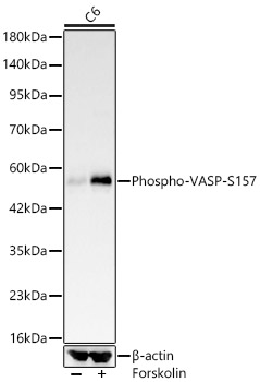 Phospho-VASP-S157 Monoclonal Antibody [8V8I0]