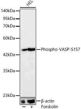 Phospho-VASP-S157 Monoclonal Antibody [2P0U3]