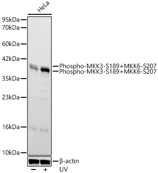 Phospho-MKK3-S189+MKK6-S207 Monoclonal Antibody [1Z3S1]