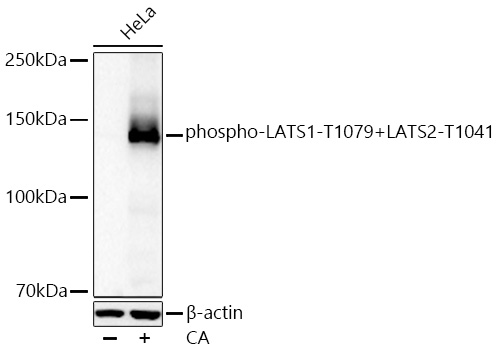 phospho-LATS1-T1079+LATS2-T1041 Monoclonal Antibody [3R10U0]
