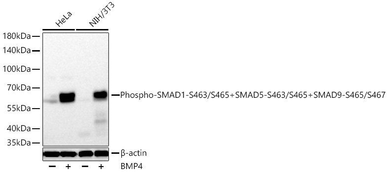 Phospho-SMAD1-S463/S465+SMAD5-S463/S465+SMAD9-S465/S467 Monoclonal Antibody [8K3G7]