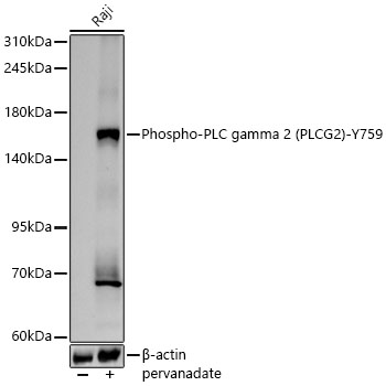 Phospho-PLC gamma 2 (PLCG2)-Y759 Monoclonal Antibody [9R7G9]