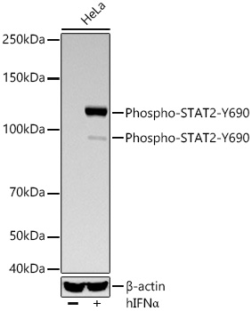 Phospho-STAT2-Y690 Monoclonal Antibody [8O0B7]