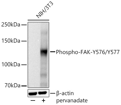 Phospho-FAK-Y576/Y577 Monoclonal Antibody [7H6A10]