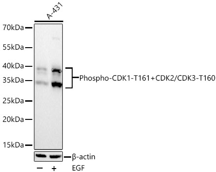 Phospho-CDK1-T161+CDK2/CDK3-T160 Monoclonal Antibody [7P2J5]