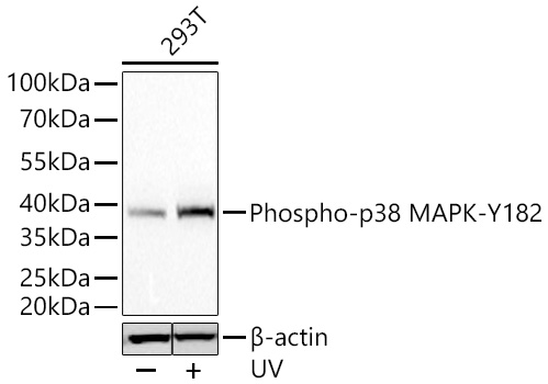 Phospho-p38 MAPK-Y182 Monoclonal Antibody [5K9P1]