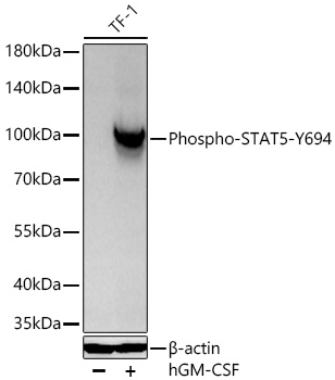 Phospho-STAT5-Y694 Monoclonal Antibody [4H1O4]