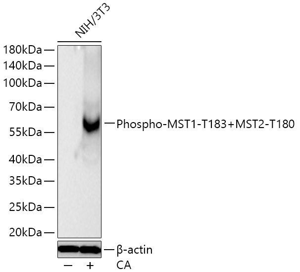Phospho-MST1-T183+MST2-T180 Monoclonal Antibody [4B1Q1]