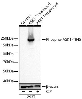 Phospho-ASK1-T845 Monoclonal Antibody [2N1D1]