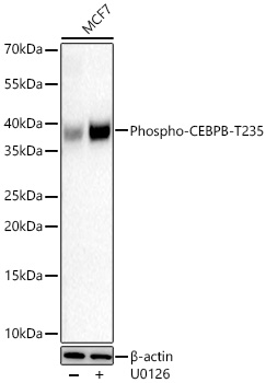 Phospho-CEBPB-T235 Monoclonal Antibody [3G0M3]