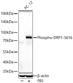Phospho-DRP1-S616 Monoclonal Antibody [8Q2H1]