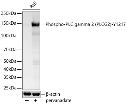 Phospho-PLC gamma 2 (PLCG2)-Y1217 Monoclonal Antibody [2I2N9]