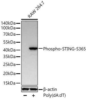 Phospho-STING/TMEM173-S365 Monoclonal Antibody [10G4J7]
