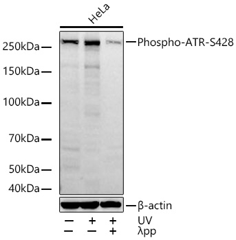 Phospho-ATR-S428 Monoclonal Antibody [2Z3M7]