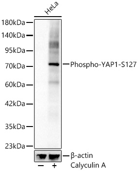 Phospho-YAP1-S127 Monoclonal Antibody [9P1I8]