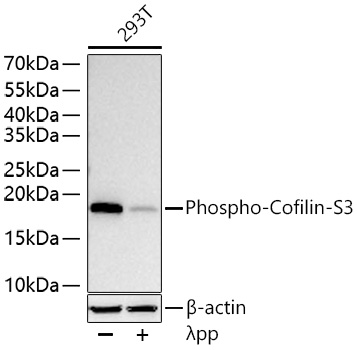 Phospho-Cofilin-S3 Monoclonal Antibody [7G1H6]
