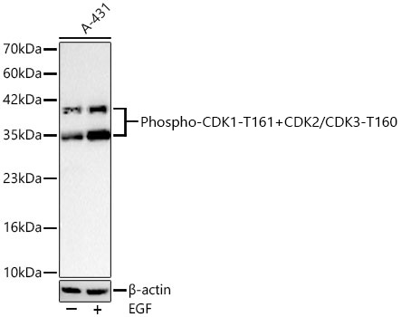 Phospho-CDK1-T161+CDK2/CDK3-T160 Monoclonal Antibody [5J5K4]
