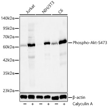 Phospho-Akt-S473 Monoclonal Antibody [2W8C3]