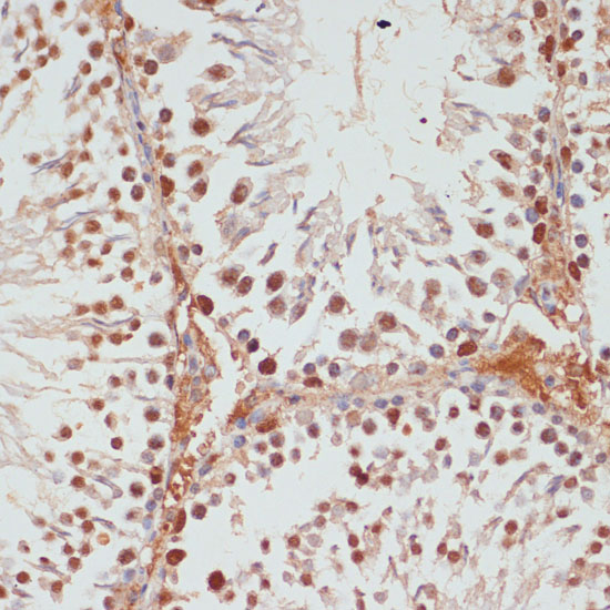 PARP1 Polyclonal Antibody