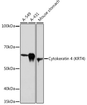 Cytokeratin 4 (KRT4) Monoclonal Antibody [6H9R6]