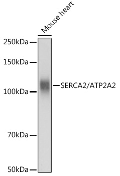 SERCA2/ATP2A2 Polyclonal Antibody