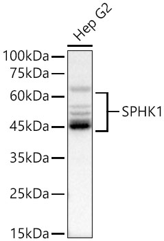 SPHK1 Polyclonal Antibody