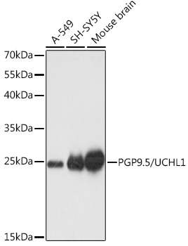 PGP9.5/UCHL1 Polyclonal Antibody