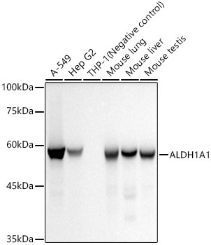 ALDH1A1 Monoclonal Antibody [3X6B2]