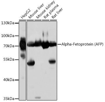 Alpha-Fetoprotein (AFP) Polyclonal Antibody
