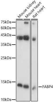 FABP4 Polyclonal Antibody