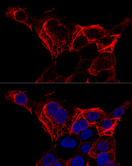 Cytokeratin 20 (KRT20) Polyclonal Antibody