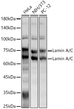 Lamin A/C Polyclonal Antibody