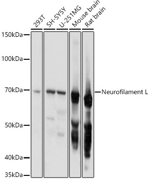 Neurofilament L Polyclonal Antibody
